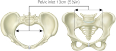 Why Is My Cervix Not Dilating   In the First Stages of Labor  - 10