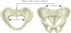 Why Is My Cervix Not Dilating   In the First Stages of Labor  - 17