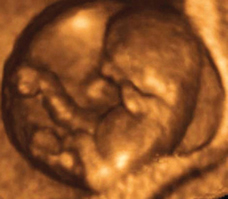 baby ultrasound at 12 weeks