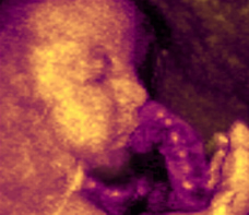 25 weeks fetus ultrasound