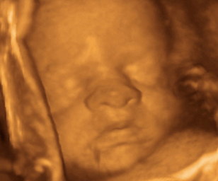 30 weeks pregnant ultrasound