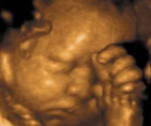 32 weeks pregnancy ultrasound vs 2 weeks old 🤍